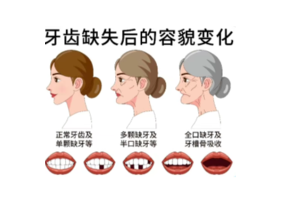 【科學(xué)科普】十個(gè)常用的口腔小知識(shí)！