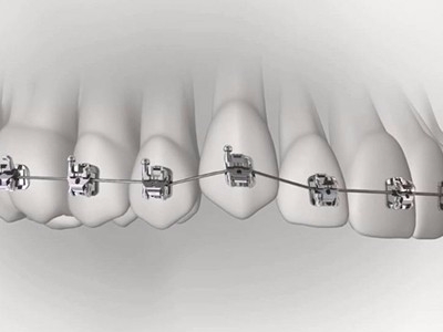 承德市哪家口腔醫(yī)院口腔正畸做得好？惟德口腔醫(yī)院來告訴您